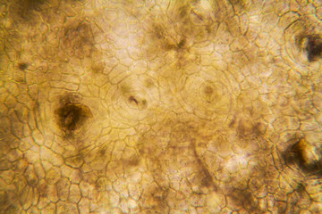 Onion root cells at the microscope 
