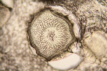 Onion root cells at the microscope 
