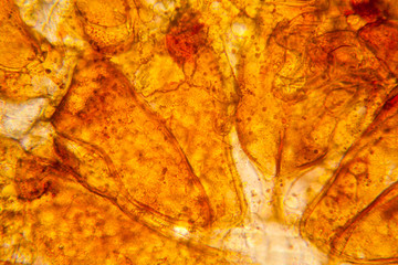 Fresh pond water plankton and algae at the microscope. Pond mite body parts
