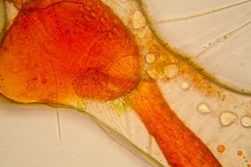 Fresh pond water plankton and algae at the microscope. Pond mite body parts
