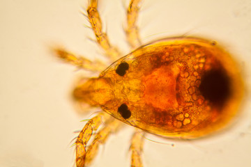 Fresh pond water plankton and algae at the microscope. Pond mite

