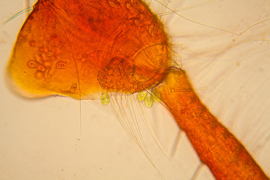 Fresh pond water plankton and algae at the microscope. Pond mite body parts
