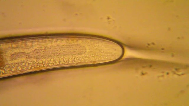 Fresh pond water plankton and algae at the microscope. Nematode

