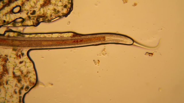 Fresh pond water plankton and algae at the microscope. Nematode
