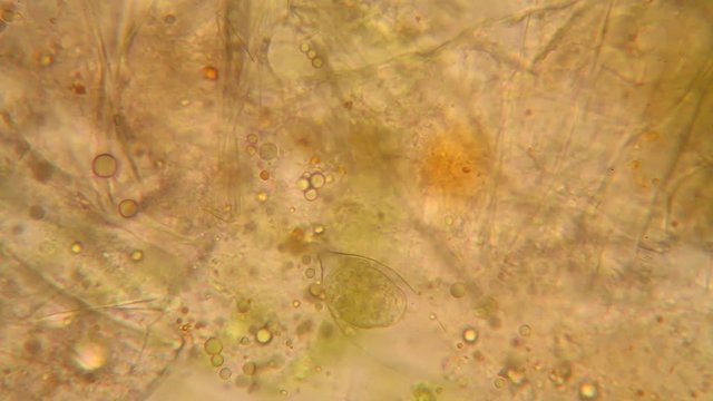 Fresh pond water plankton and algae at the microscope

