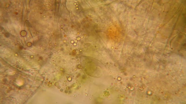 Fresh pond water plankton and algae at the microscope
