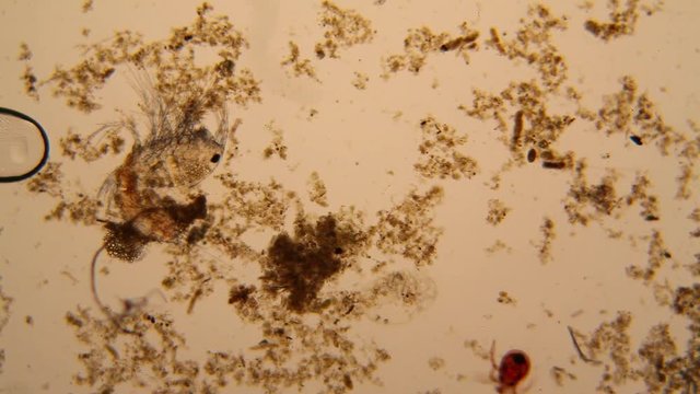 Fresh pond water plankton and algae at the microscope. Pond mite and dead copepod