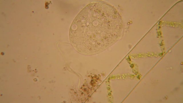 Fresh water plankton and algae at the microscope. Vorticella convallaria and cilliate
