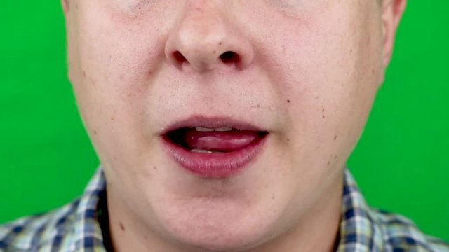 Infection tongue disease candida albicans