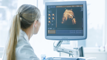 In the Hospital, Obstetrician Uses Transducer for Ultrasound/ Sonogram Screening / Scanning Belly...