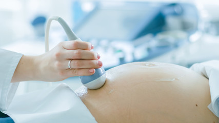In the Hospital, Close-up Shot of the Doctor Doing Ultrasound / Sonogram Scan to a Pregnant Woman....