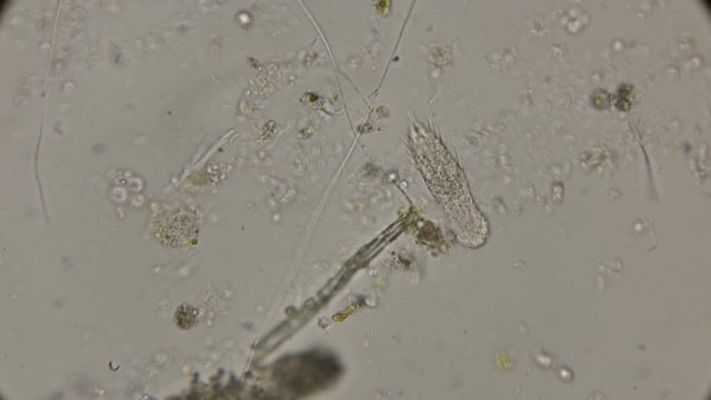 Brûhoresničnye worms Gastrotricha under the microscope
