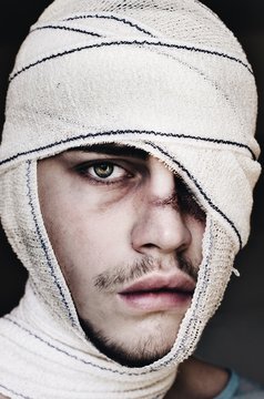 gueule cass&eacute;s