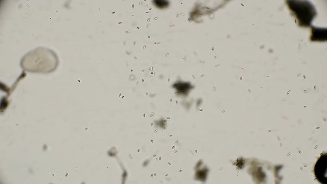 colony of the simplest microorganisms including parasites under a microscope