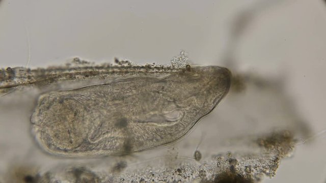 ciliated flat worm under a microscope