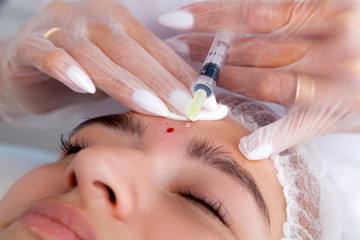 The doctor cosmetologist makes the Rejuvenating facial injections procedure for tightening and smoothing wrinkles on the face skin of a beautiful, young woman in a beauty salon.Cosmetology skin care.