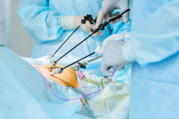 Close up of hands of surgeons team during operation uterus removal with surgical laparoscopy...