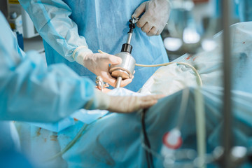 Close up of hands of surgeons team during process operation uterus removal with surgical...
