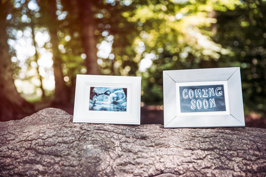 Baby Ultrasound and Coming Soon Photo Frames on Tree Trunk in Forest.