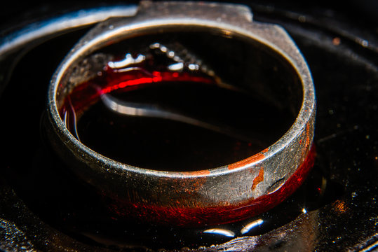 Ring in the blood is macro