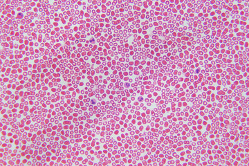Blood cells under microscope view for education