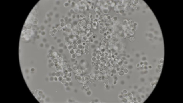 yeast is moving under the microscope