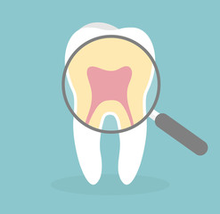 Dental inspection concept. Magnifying glass over a tooth