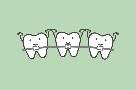 orthodontics teeth or dental braces - tooth cartoon vector flat style