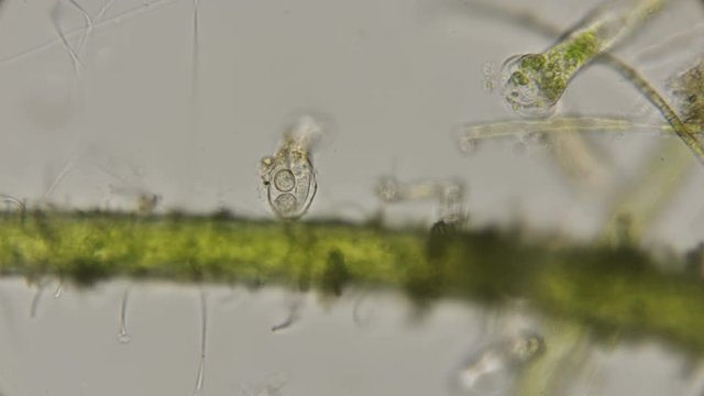 infusoria species Peritricha in the sink which got Halteria rubra, under a microscope