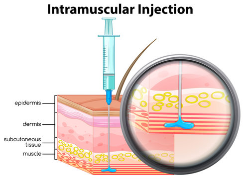 Human Skin Intramuscular Injection