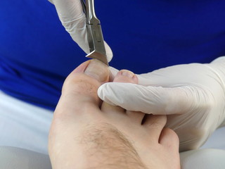 podologie podiatrist podiatry