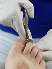 podologie podiatrist podiatry