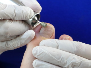 fußpflege pedicure podologie
