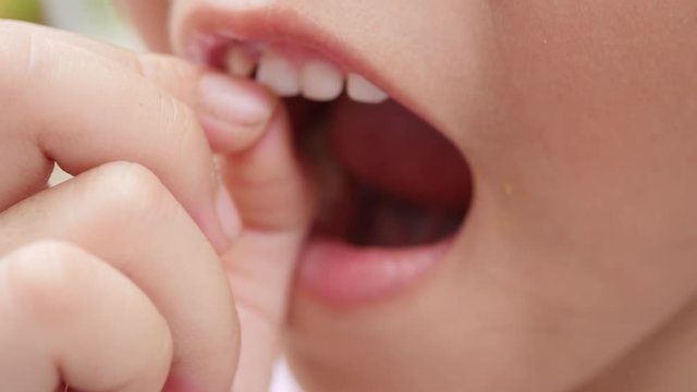 Close up of little girl is wiggle her milk tooth.