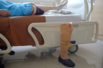 The older with prosthetic leg sleep on bed in hospital.