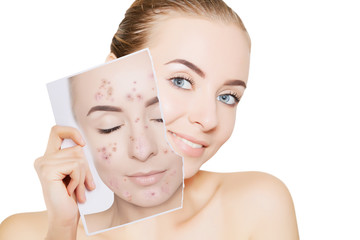 portrait of woman with clean skin holding portrait with pimpled skin