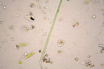 Microscopic organisms in pond water.  Oscillatoria simplicissima and Euglena Gracilis
