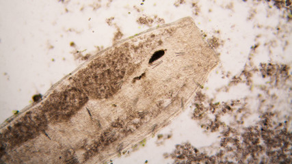 Microscopic organisms from the pond water. Nematode - details
