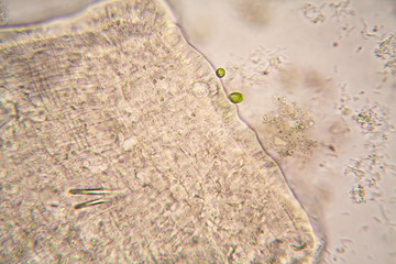 Microscopic organisms from the pond water. Nematode - details
