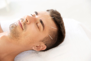 Young man undergoing acupuncture treatment in salon - obrazy, fototapety, plakaty