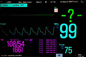 Normal heart function on pulse oximeter pleth graph bar