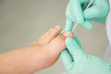 doctor-Podiatry with tools