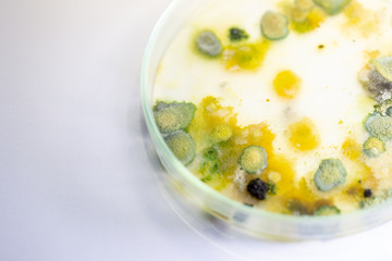 Backgrounds of Colony Characteristics of Fungus and algae in petri dish for education.