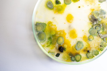 Backgrounds of Colony Characteristics of Fungus and algae in petri dish for education.