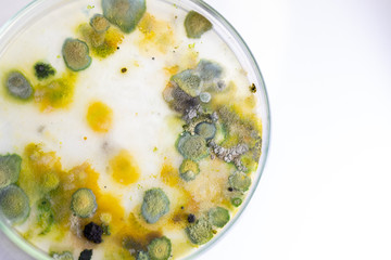 Backgrounds of Colony Characteristics of Fungus and algae in petri dish for education.