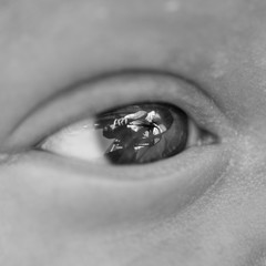 Newborn eye