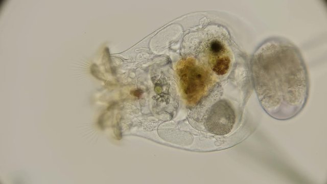 brachionus plicatilis rotifer, how it feeds and how microorganisms get into her stomach, a good example, under a microscope