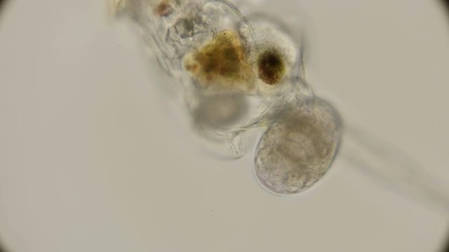 the rotifer Brachionus plicatilis with eggs, you can see all the internal organs and how they work, under the microscope