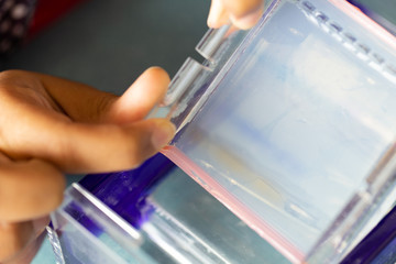 Agarose gel electrophoresis is a method of gel electrophoresis used in biochemistry, molecular biology, genetics, and clinical chemistry in lab.