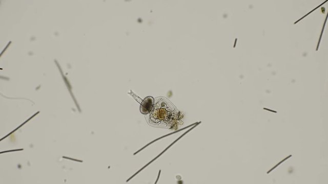 brachionus plicatilis rotifer, how it feeds and how microorganisms get into her stomach, a good example, under a microscope